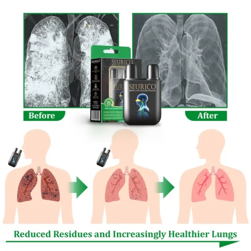 Seurico™ herbal lung cleansing inhaler Inhaler