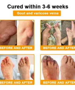 Seurico™ Botox & Bee Venom Rapid Bone Repair Cream