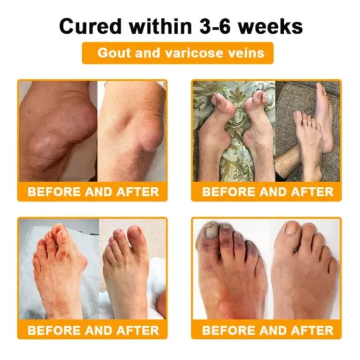 Seurico™ Botox & Bee Venom Rapid Bone Repair Cream