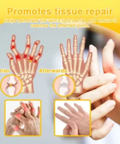 Seurico™ Botox & Bee Venom Rapid Bone Repair Cream