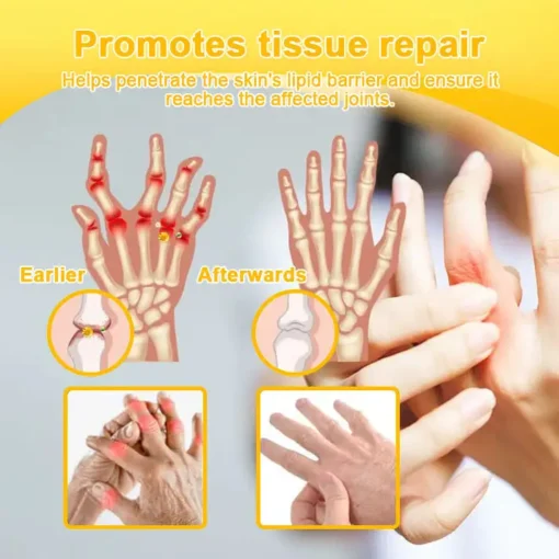 Seurico™ Botox & Bee Venom Rapid Bone Repair Cream