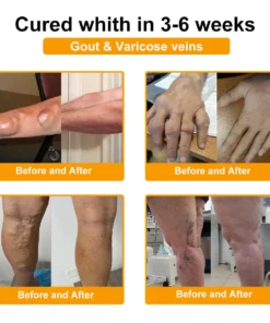 Seurico™ Botox & Bee Venom Rapid Bone Repair Cream
