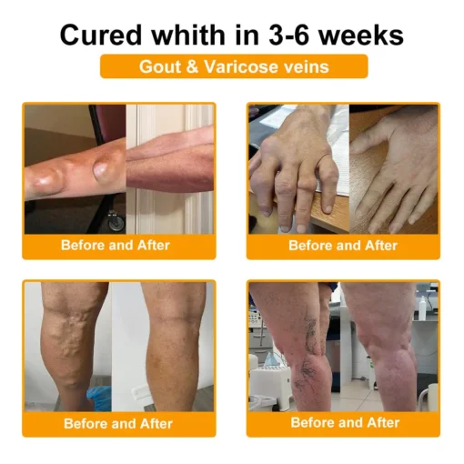 Seurico™ Botox & Bee Venom Rapid Bone Repair Cream