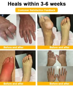 Seurico™ Botox & Bee Venom Rapid Bone Repair Cream