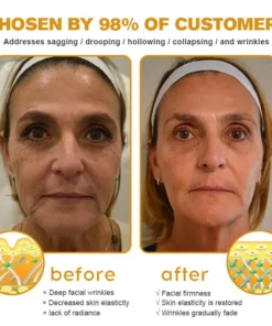 Seurico™ Botox Bee Venom Wrinkle Removal Cream