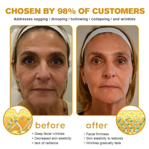 Seurico™ Botox Bee Venom Wrinkle Removal Cream