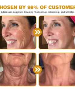 Seurico™ Botox Bee Venom Wrinkle Removal Cream