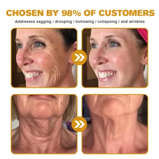Seurico™ Botox Bee Venom Wrinkle Removal Cream
