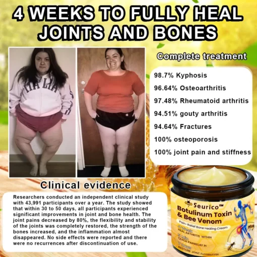 Seurico™ Botulinum Toxin & Bee Venom Pain-Relief Bone Healing Cream