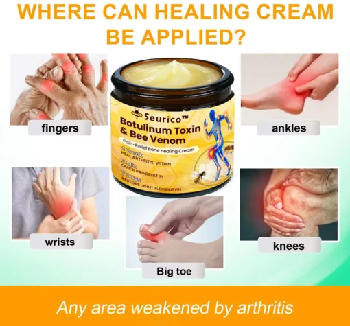 Seurico™ Botulinum Toxin & Bee Venom Pain-Relief Bone Healing Cream