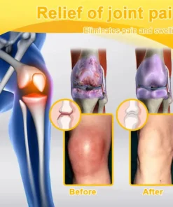 Seurico™ Botulinum Toxin & Bee Venom Pain-Relief Bone Healing Cream