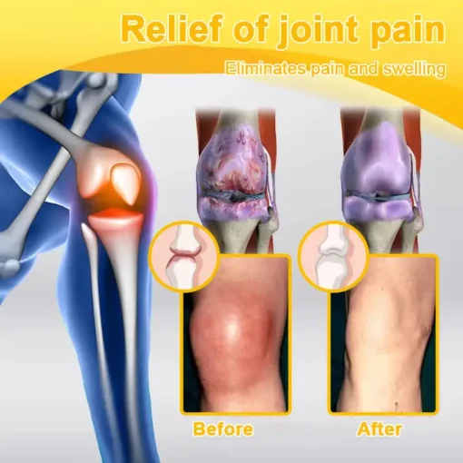 Seurico™ Botulinum Toxin & Bee Venom Pain-Relief Bone Healing Cream