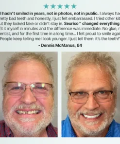 Seurico™ SnapPerfect Dentures