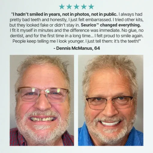 Seurico™ SnapPerfect Dentures
