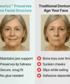 Seurico™ SnapPerfect Dentures
