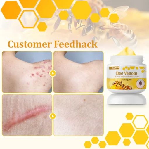 Seurico™ TagCure Bee Venom Cream