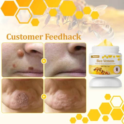 Seurico™ TagCure Bee Venom Cream