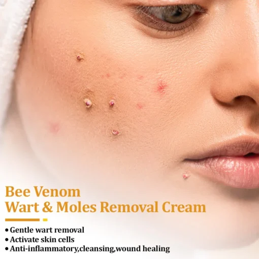 Seurico™ TagCure Bee Venom Cream
