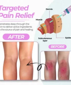 Seurico™ Varicose Veins Cream