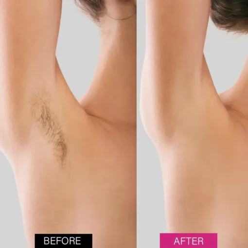 Seurico™ BeeSilk Hair Removal Mousse