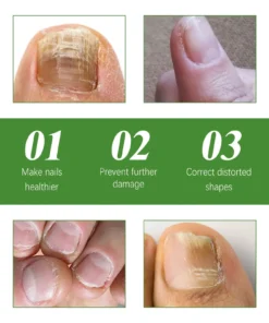 Seurico™ Fungal Inhibiting Stick