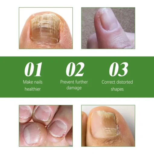 Seurico™ Fungal Inhibiting Stick