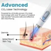 Seurico™ Laser Pen - Non-invasive Mole and Wart Removal