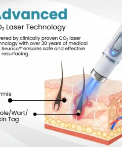 Seurico™ Laser Pen - Non-invasive Mole and Wart Removal