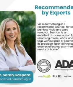 Seurico™ Laser Pen - Non-invasive Mole and Wart Removal