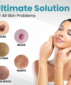 Seurico™ Laser Pen - Non-invasive Mole and Wart Removal