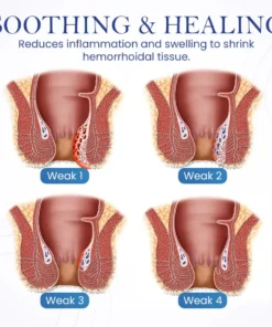 Seurico™ Herbal Hemorrhoid Treatment