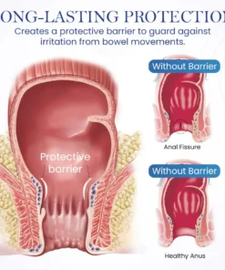 Seurico™ Herbal Hemorrhoid Treatment