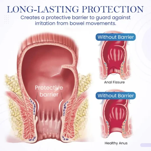 Seurico™ Herbal Hemorrhoid Treatment