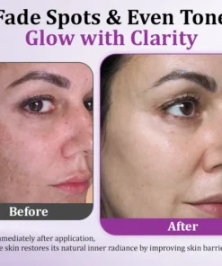 Seurico™ MelantraY Anti-Hyperpigmentation Essence