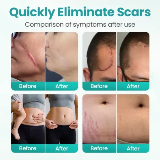 Seurico® EliteAloe ScarSolve Spray