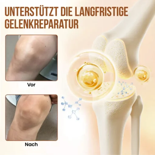 Seurico™ Joint Comfort Spray