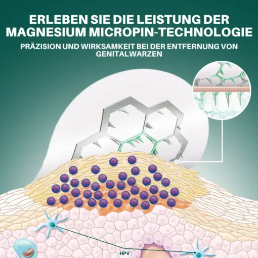 Seurico™ Magnesium Mikropin HPV Genitalien Warzen Entfernung Patch Pro