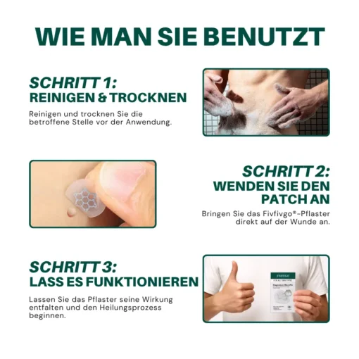 Seurico™ Magnesium Mikropin HPV Genitalien Warzen Entfernung Patch Pro