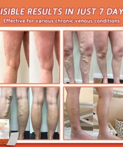 Seurico™ Vein Ease Microneedle Care Patch