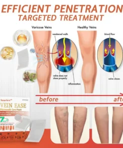 Seurico™ Vein Ease Microneedle Care Patch