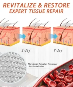 Seurico™ Vein Ease Microneedle Care Patch