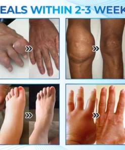 Seurico™ Magnesium Pain & Bone Healing Cream