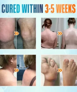 Seurico™ Premium Curcumin Pain Relief Gel