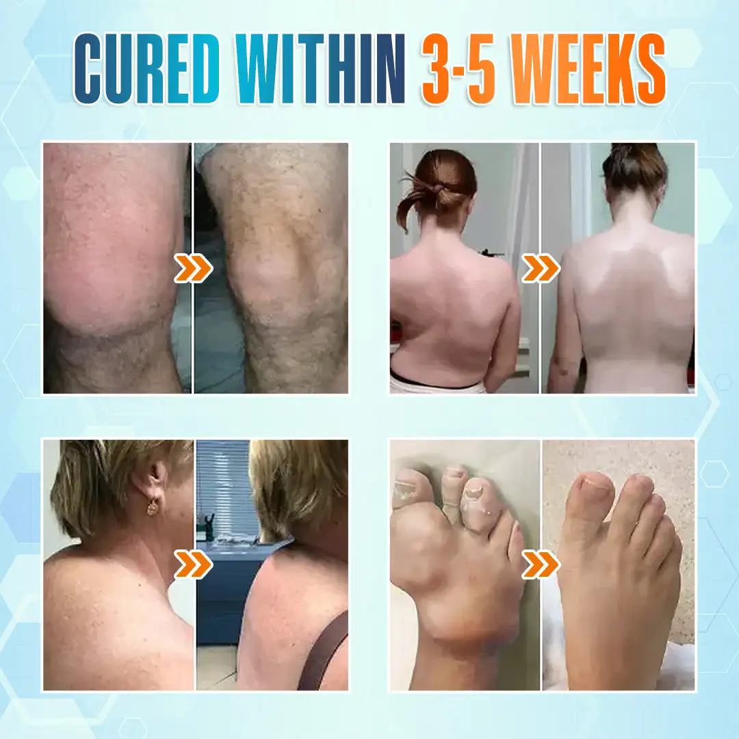 Seurico™ Premium Curcumin Pain Relief Gel