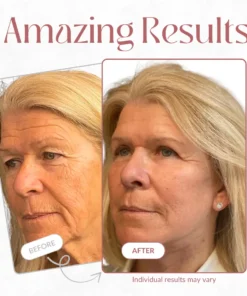 Seurico Calcium Anti-Wrinkle Balm