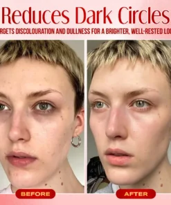 Seurico™ Instant Eye Bag Eraser