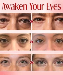 Seurico™ Instant Eye Bag Eraser