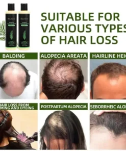 Seurico Organic Rosemary Hair Growth Shampoo & Hair Conditioner