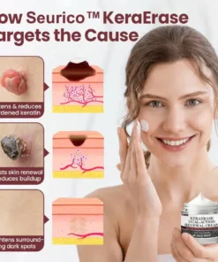 Seurico™KeraErase Dual-Action Renewal Cream