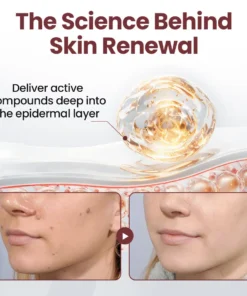 Seurico™KeraErase Dual-Action Renewal Cream